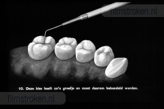 Tandverzorging voor de Jeugd