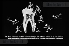 Tandverzorging voor de Jeugd