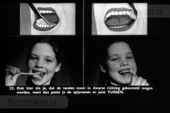 Tandverzorging voor de Jeugd