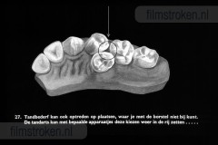 Tandverzorging voor de Jeugd